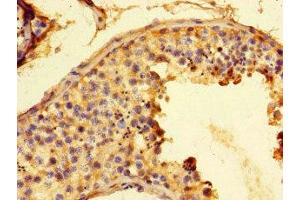 Immunohistochemistry of paraffin-embedded human testis tissue using ABIN7153916 at dilution of 1:100 (Glucose-6-Phosphate Dehydrogenase Antikörper  (AA 80-185))