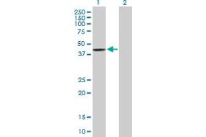 Western Blot analysis of SCCPDH expression in transfected 293T cell line by SCCPDH MaxPab polyclonal antibody. (SCCPDH Antikörper  (AA 1-429))