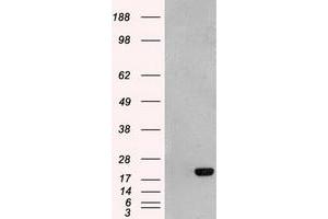 HEK293T cells were transfected with the pCMV6-ENTRY control (Left lane) or pCMV6-ENTRY AK1 (Right lane) cDNA for 48 hrs and lysed. (Adenylate Kinase 1 Antikörper)