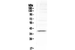 Western blot analysis of Tal1 using anti-Tal1 antibody . (TAL1 Antikörper  (AA 174-259))