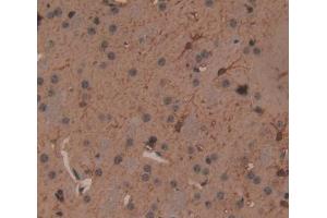 IHC-P analysis of Mouse Tissue, with DAB staining. (Fascin Antikörper  (AA 27-273))