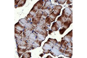 IHC analysis of RAB7/RAB7A using anti-RAB7/RAB7A antibody (ABIN7600597).