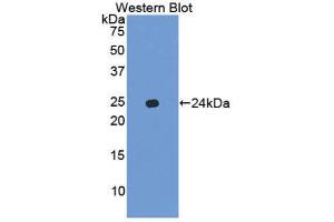 Western Blotting (WB) image for anti-Chemokine (C-X-C Motif) Ligand 15 (CXCL15) (AA 26-167) antibody (ABIN3205522) (Chemokine (C-X-C Motif) Ligand 15 (CXCL15) (AA 26-167) Antikörper)