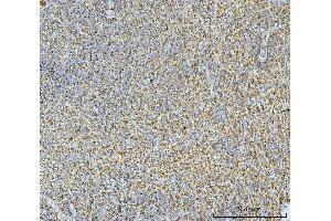 IHC analysis of CA1 using anti-CA1 antibody (ABIN3043766). (CA1 Antikörper  (AA 9-261))