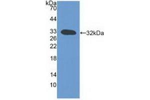 Detection of Recombinant LTb, Mouse using Polyclonal Antibody to Lymphotoxin Beta (LTb)