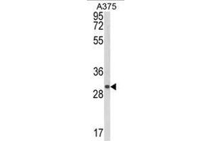 Western blot analysis of CTHRC1 Antibody (N-term) in A375 cell line lysates (35ug/lane). (CTHRC1 Antikörper  (N-Term))