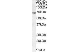 Western Blotting (WB) image for gamma-aminobutyric Acid (GABA) A Receptor, alpha 4 (GABRA4) peptide (ABIN368995) (gamma-aminobutyric Acid (GABA) A Receptor, alpha 4 (GABRA4) Peptid)