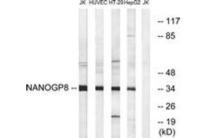Western blot analysis of extracts from HuvEc/HT-29/HepG2/Jurkat cells, using NANOGP8 Antibody. (NANOGP8 Antikörper  (AA 51-100))