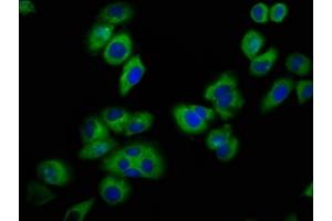 Immunofluorescence staining of A549 cells with ABIN7153289 at 1:100, counter-stained with DAPI. (KCNJ5 Antikörper  (AA 348-419))