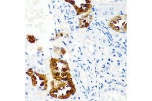Immunohistochemistry of paraffin-embedded rat kidney using CST1 antibody at dilution of 1:100 (40x lens).