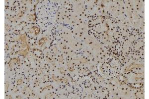 ABIN6273801 at 1/100 staining Rat kidney tissue by IHC-P. (NUAK2 Antikörper  (Internal Region))