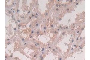 IHC-P analysis of Human Kidney Tissue, with DAB staining. (IL-5 Antikörper  (AA 20-134))