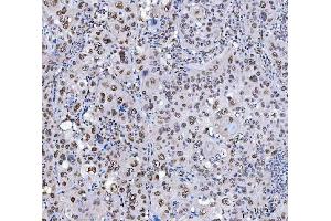 IHC analysis of SCML1 using anti-SCML1 antibody (ABIN7602479).