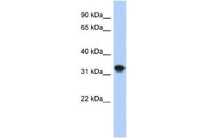 Western Blotting (WB) image for anti-Centromere Protein P (CENPP) antibody (ABIN2459748)