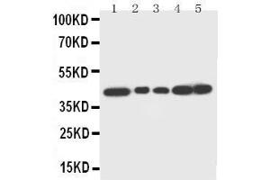 Anti-Decorin antibody, Western blotting Lane 1: Rat Liver Tissue Lysate Lane 2: Rat Lung Tissue Lysate Lane 3: Rat Spleen Tissue Lysate Lane 4: SMMC Cell Lysate Lane 5: SMMC Cell Lysate (Decorin Antikörper  (C-Term))