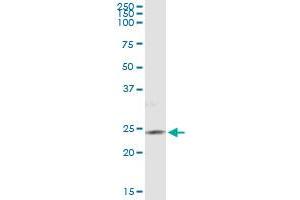 Immunoprecipitation of PIP5K1C transfected lysate using anti-PIP5K1C monoclonal antibody and Protein A Magnetic Bead , and immunoblotted with PIP5K1C MaxPab rabbit polyclonal antibody. (PIP5K1C Antikörper  (AA 561-667))