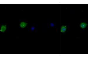 Detection of IL10Ra in Human MCF7 cell using Polyclonal Antibody to Interleukin 10 Receptor Alpha (IL10Ra) (IL-10RA Antikörper  (AA 132-235))