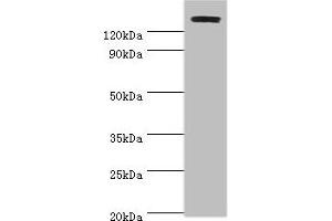 Western blot All lanes: TP53BP2 antibody at 2 μg/mL + Mouse thymus Secondary Goat polyclonal to rabbit IgG at 1/10000 dilution Predicted band size: 126, 112, 127 kDa Observed band size: 126 kDa (TP53BP2 Antikörper  (AA 360-600))