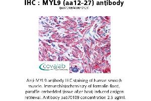 Image no. 1 for anti-Myosin Regulatory Light Chain 2, Smooth Muscle Isoform (MYL9) (AA 12-27) antibody (ABIN1737166) (MYL9 Antikörper  (AA 12-27))