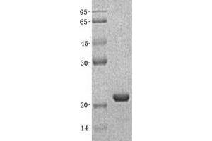 Western Blotting (WB) image for Neurocalcin delta (NCALD) (Transcript Variant 1) protein (His tag) (ABIN2726873)
