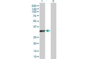 Western Blot analysis of SYCP3 expression in transfected 293T cell line by SYCP3 MaxPab polyclonal antibody. (SYCP3 Antikörper  (AA 1-236))