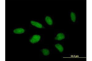Immunofluorescence of purified MaxPab antibody to TTC23 on HeLa cell. (TTC23 Antikörper  (AA 1-393))