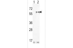 Western blot analysis of PIP5K1A (arrow) using rabbit polyclonal hPIP5K1A-R34 (ABIN392593 and ABIN2842123). (PIP5K1A Antikörper  (N-Term))
