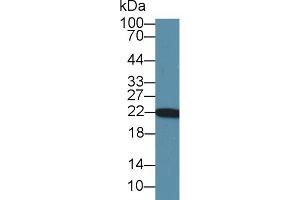 Western blot analysis of Rat Heart lysate, using Rat PARK7 Antibody (1 µg/ml) and HRP-conjugated Goat Anti-Rabbit antibody ( (PARK7/DJ1 Antikörper  (AA 1-189))