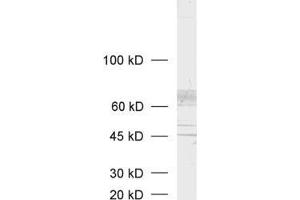 dilution: 1 : 1000, sample: synaptic vesicle fraction of rat brain (LP2) (SLC18A3 Antikörper  (C-Term))