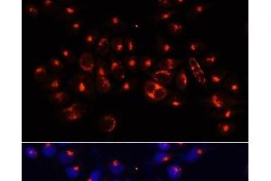 Immunofluorescence analysis of 293T cells using AARS Polyclonal Antibody at dilution of 1:100 (40x lens).