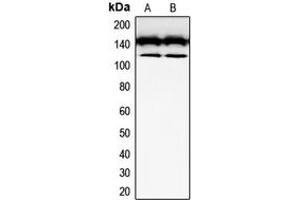 Western blot analysis of CD117 expression in SKNSH (A), Jurkat (B) whole cell lysates. (KIT Antikörper  (Center))
