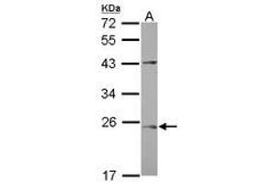 Image no. 1 for anti-Chromosome 1 Open Reading Frame 146 (C1ORF146) (AA 1-180) antibody (ABIN1497028) (C1ORF146 Antikörper  (AA 1-180))