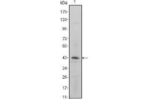 Western blot analysis using ITGA5 mouse mAb against ITGA5-hIgGFc transfected HEK293 cell lysate. (ITGA5 Antikörper)