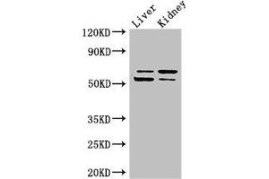 Western Blot Positive WB detected in: Mouse liver tissue, Mouse kidney tissue All lanes: LMBRD1 antibody at 4 μg/mL Secondary Goat polyclonal to rabbit IgG at 1/50000 dilution Predicted band size: 62, 45, 54, 22 kDa Observed band size: 62, 54 kDa (LMBRD1 Antikörper  (AA 6-100))