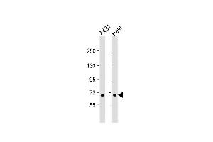 All lanes : Anti-CCD Antibody (N-term) at 1:1000 dilution Lane 1: A431 whole cell lysate Lane 2: Hela whole cell lysate Lysates/proteins at 20 μg per lane. (CCDC120 Antikörper  (N-Term))