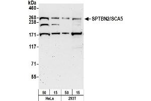 Western Blotting (WB) image for anti-Spectrin, Beta, Non-erythrocytic 2 (SPTBN2) (AA 2340-2390) antibody (ABIN7450766)