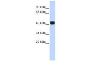 Image no. 1 for anti-TRIO and F-Actin Binding Protein (TRIOBP) (AA 144-193) antibody (ABIN6742513) (TRIOBP Antikörper  (AA 144-193))
