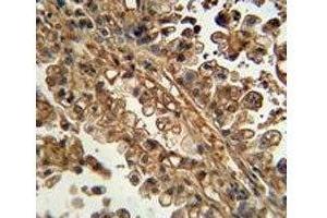 Immunohistochemistry (IHC) image for anti-ATP-Binding Cassette, Sub-Family G (WHITE), Member 1 (ABCG1) (AA 168-195) antibody (ABIN3030058)