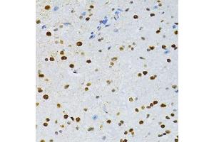 Immunohistochemistry of paraffin-embedded mouse spinal cord using SNRNP70 antibody. (SNRNP70 Antikörper  (AA 150-250))