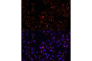 Immunofluorescence analysis of HeLa cells using WDR81 antibody (ABIN6294099) at dilution of 1:100. (WDR81 Antikörper)