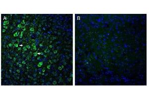 Expression of ADAM10 in mouse parietal cortex. (ADAM Metallopeptidase Domain 10 (ADAM10) Peptid)