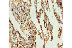 Immunohistochemistry of paraffin-embedded human lung tissue using ABIN7169989 at dilution of 1:100 (Solute Carrier Family 34 (Type II Sodium/phosphate Contransporter), Member 1 (SLC34A1) (AA 1-103) Antikörper)