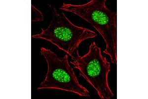 Immunofluorescent analysis of 4 % paraformaldehyde-fixed, 0. (Nucleostemin Antikörper  (N-Term))