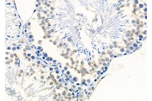 ABIN6261180 and ABIN6278834 at 1/100 staining Rat testis tissue by IHC-P.