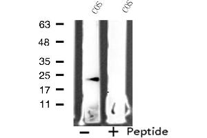 Western blot analysis of extracts from COS cells, using MRPL11 antibody. (MRPL11 Antikörper  (Internal Region))