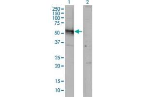 Western Blot analysis of AGT expression in transfected 293T cell line by AGT monoclonal antibody (M01), clone 1A10. (AGT Antikörper  (AA 376-485))