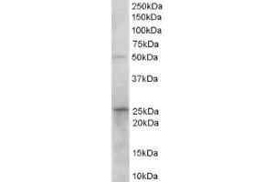 Image no. 1 for anti-Hydroxyprostaglandin Dehydrogenase 15-(NAD) (HPGD) (C-Term) antibody (ABIN374495) (HPGD Antikörper  (C-Term))
