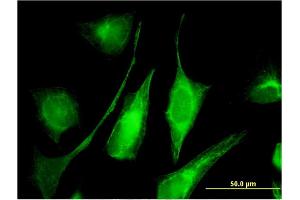 Immunofluorescence of monoclonal antibody to C6orf199 on HeLa cell. (AKD1 Antikörper  (AA 321-421))