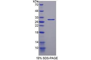 Image no. 1 for Poly (ADP-Ribose) Polymerase 1 (PARP1) (AA 788-1014) protein (His tag) (ABIN6237682) (PARP1 Protein (AA 788-1014) (His tag))