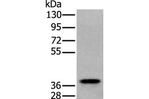 Western blot analysis of Human testis tissue lysate using ZPBP Polyclonal Antibody at dilution of 1:250 (ZPBP Antikörper)